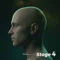 Stage Four Hair Loss