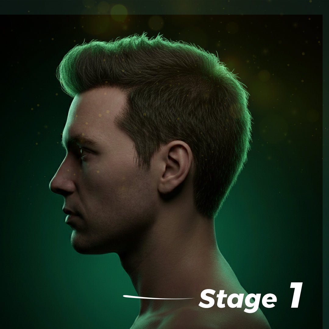 Stage One Hair Loss