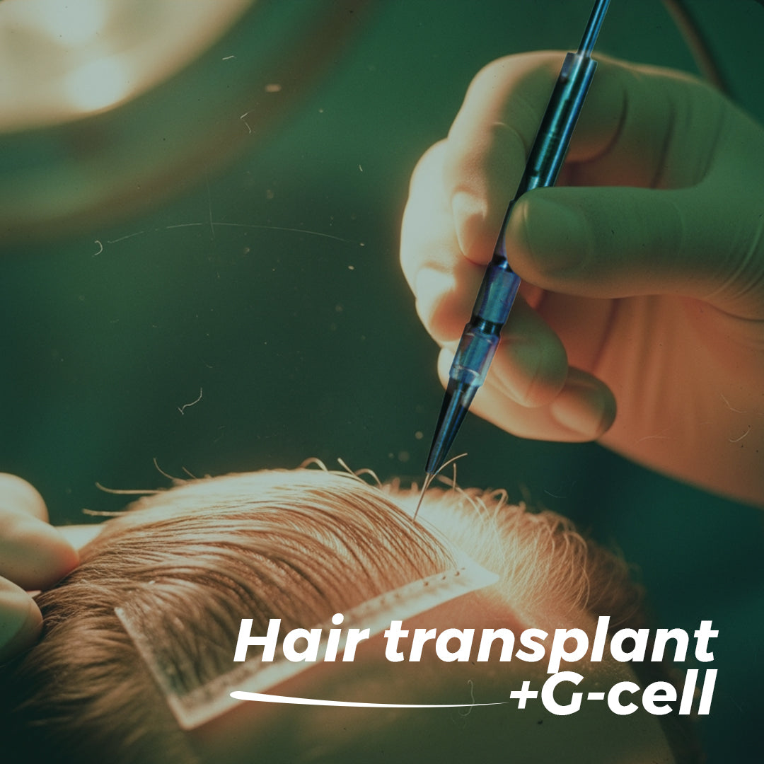 Hair Transplant