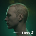 Stage Three Hair Loss